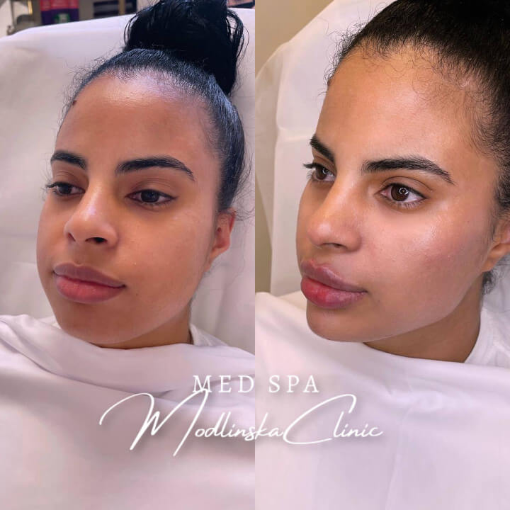 Full Face Beautification